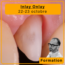 Inlays Onlays Overlays - 22-23 octobre 2026