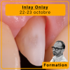 Inlay Onlay - 22-23 octobre 2026